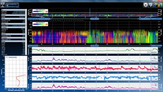 Sentinel V Waves Array by Teledyne